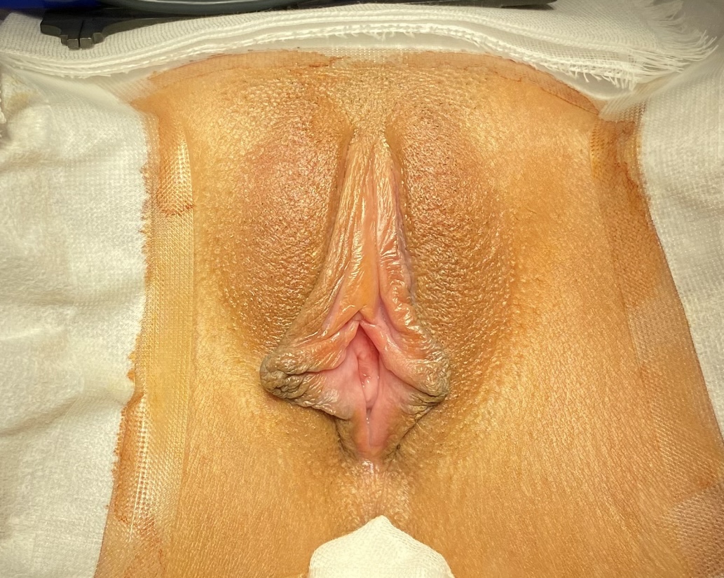 症例写真