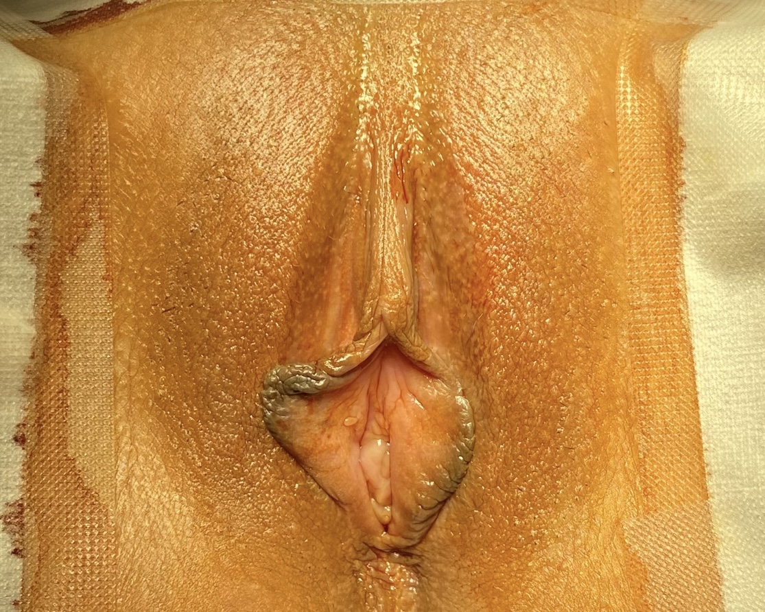 症例写真